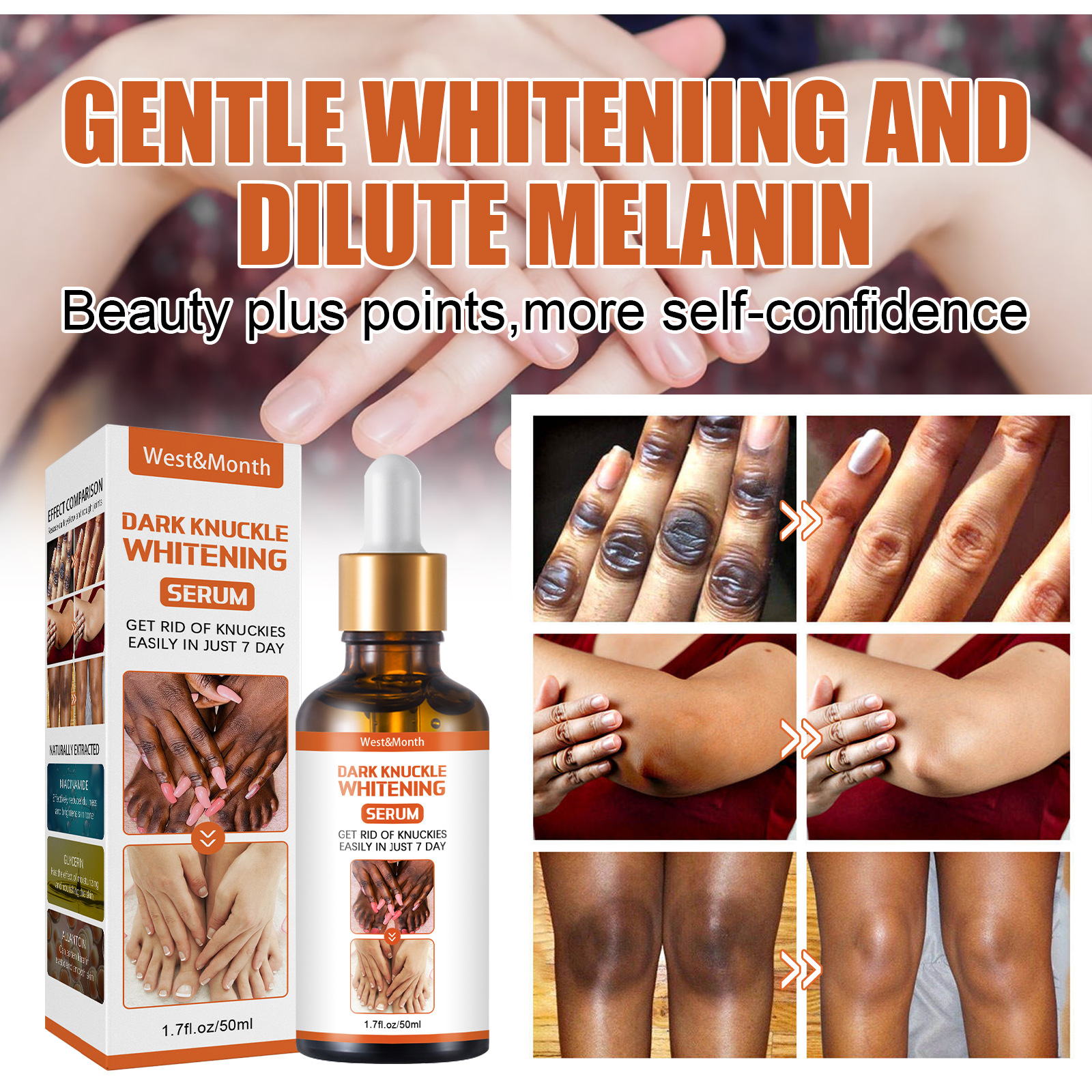 Snail Mucin Essence - Dark Knuckles Lightening Serum Hand Knuckle