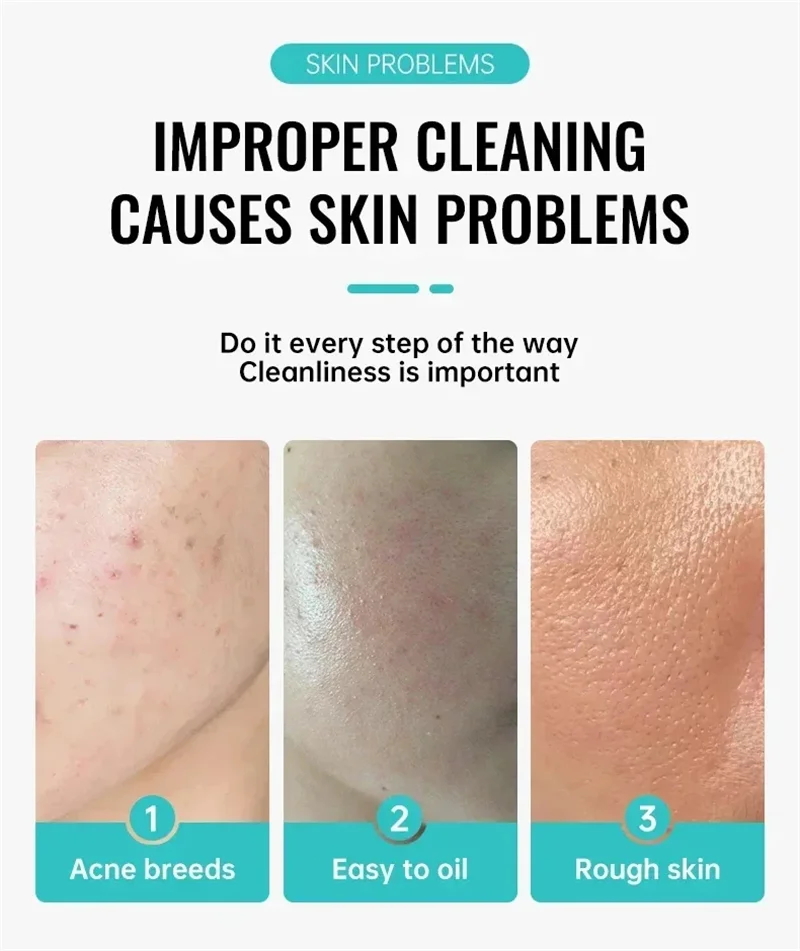 Salicylic Acid Acne Treatment  - огляд і ціна Salicylic Acid Cleanser