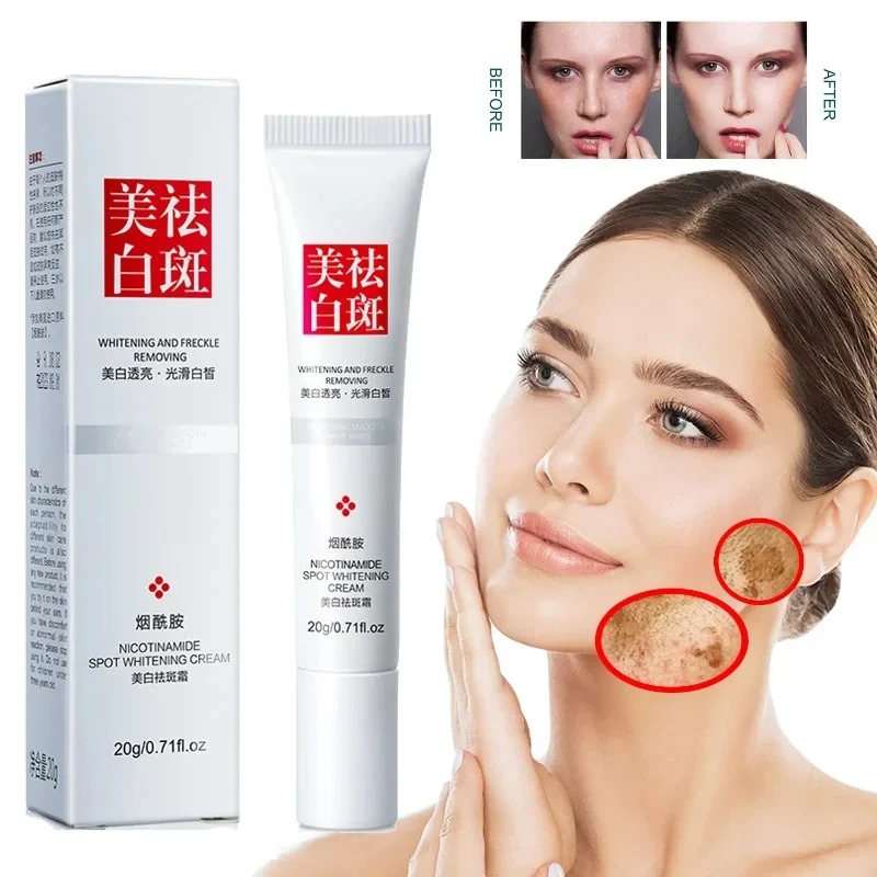 Fade and Improve Freckles Blac - огляд і ціна Skincare Olay