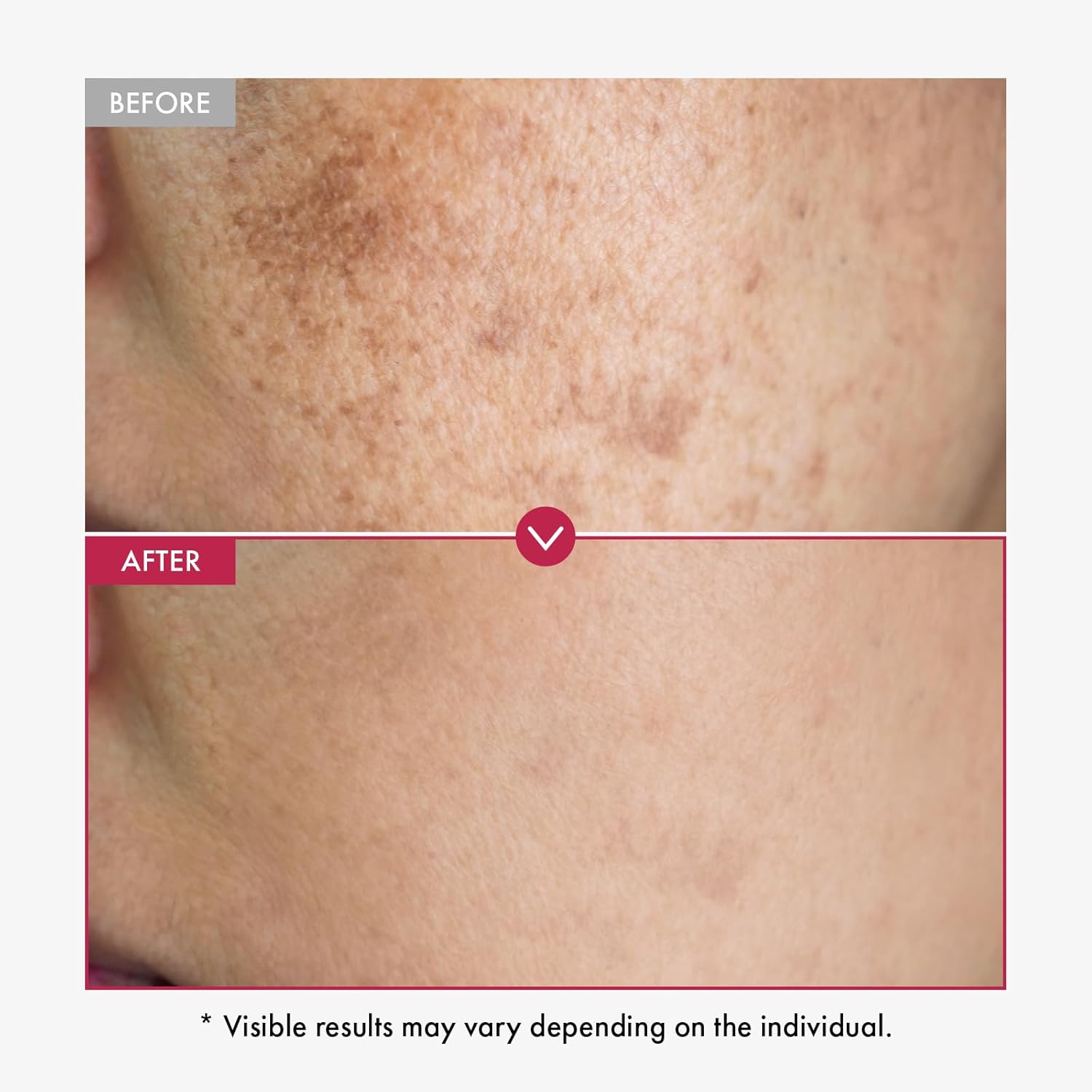 Alpha Arbutin Serum AHA Keeps  - огляд і ціна Snail Mucin Essence