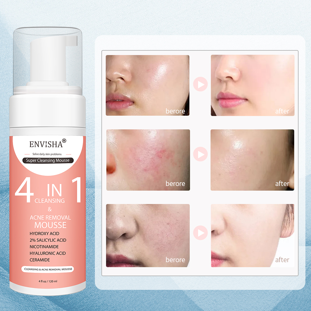 ENVISHA Facial Skin Care Exfol - огляд і ціна Salicylic Acid Cleanser